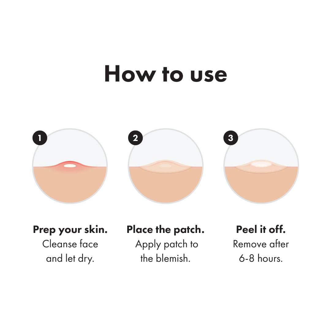 Mighty Patch™ Invisible+ Patch – The Barely-There Daytime Hydrocolloid Acne Pimple Patch for Covering Zits and Blemishes. Tapered Edges Designed to Blend Into Skin (72ct)