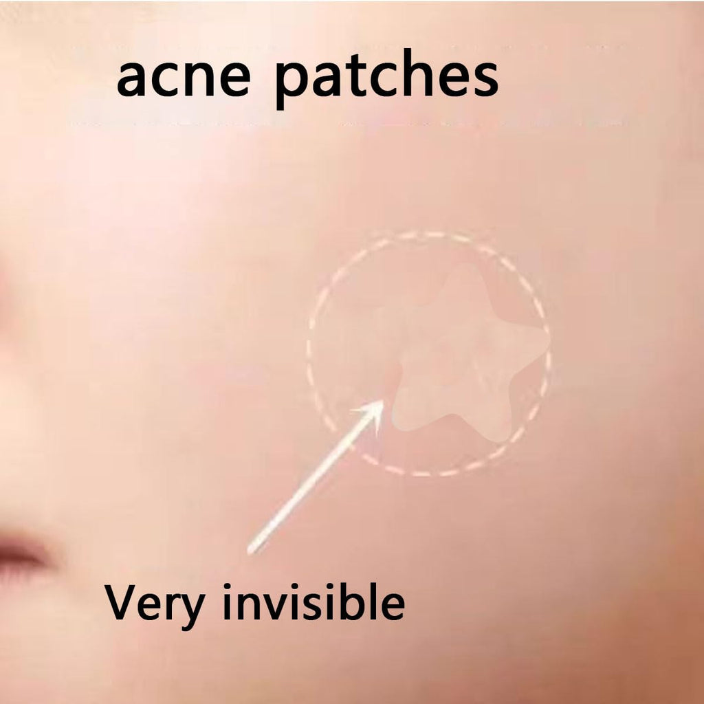 160pcs Knot Patches. Miracle Invisible Spot Coverage - Hydrocolloid Acne Patches with Tea essential oil salicylic acid and building block essence. treat acne. absorb pimples and blemishes in 2 sizes : Beauty & Personal Care