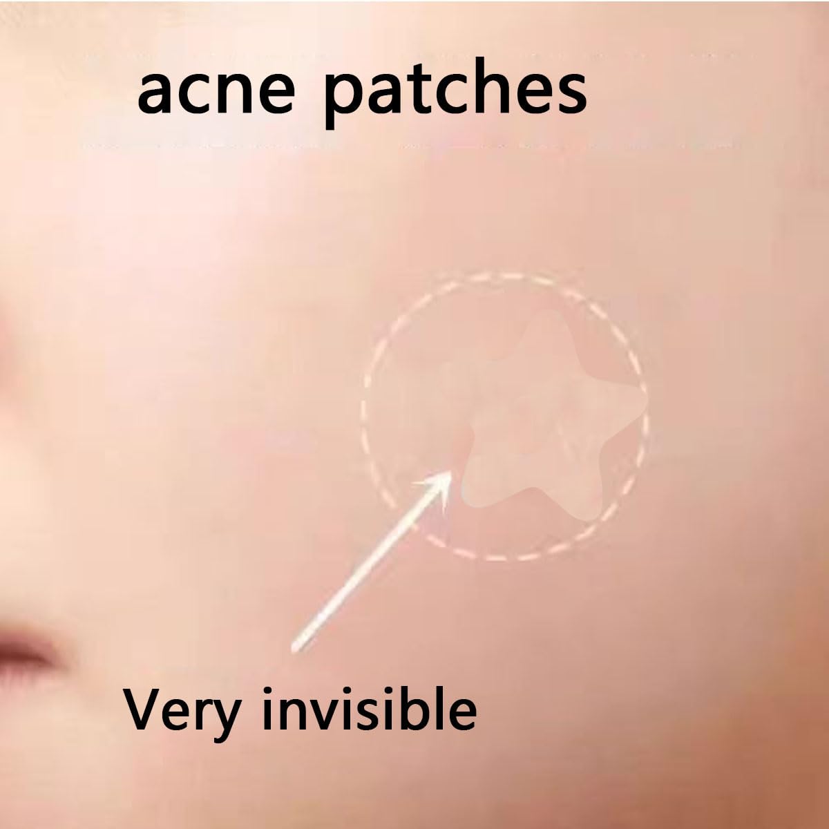 160pcs Knot Patches. Miracle Invisible Spot Coverage - Hydrocolloid Acne Patches with Tea essential oil salicylic acid and building block essence. treat acne. absorb pimples and blemishes in 2 sizes : Beauty & Personal Care