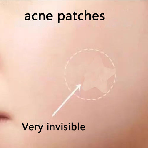 160pcs Knot Patches. Miracle Invisible Spot Coverage - Hydrocolloid Acne Patches with Tea essential oil salicylic acid and building block essence. treat acne. absorb pimples and blemishes in 2 sizes : Beauty & Personal Care
