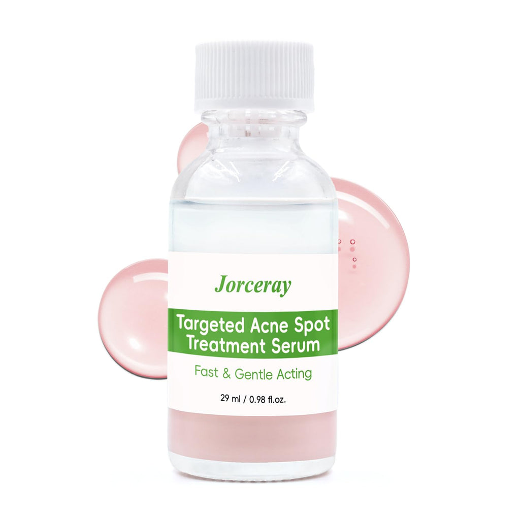 Effective Acne Treatment for Face - Acne Drying lotion - Removes Acne and Redness - Eliminating Zits - Pimple Drying Lotion 1 Fl oz