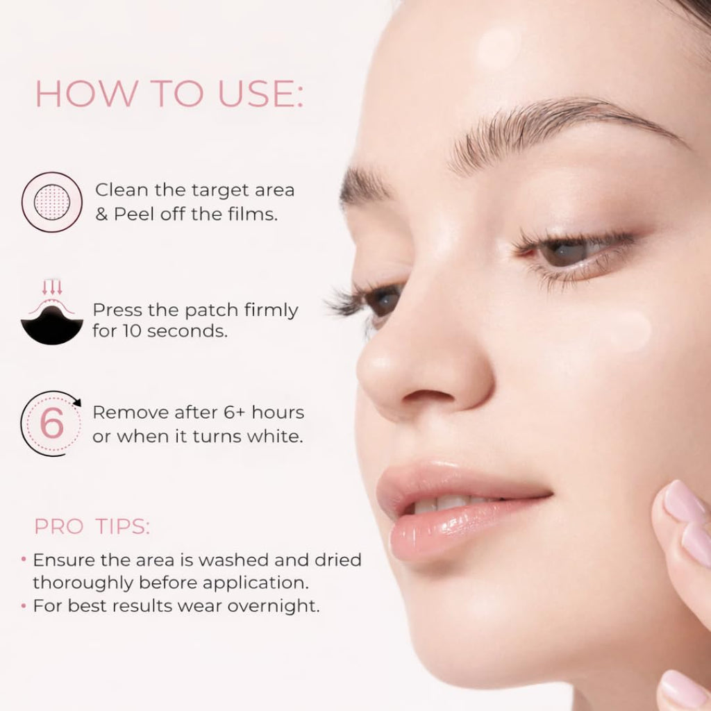 Pimple Patches – Hydrocolloid Pimple Patch Spot Stickers for Acne and Whiteheads; Day or Nighttime Use; Fast Acting. Invisible Spot Treatment for Face and Skin- 72 Count : Beauty & Personal Care