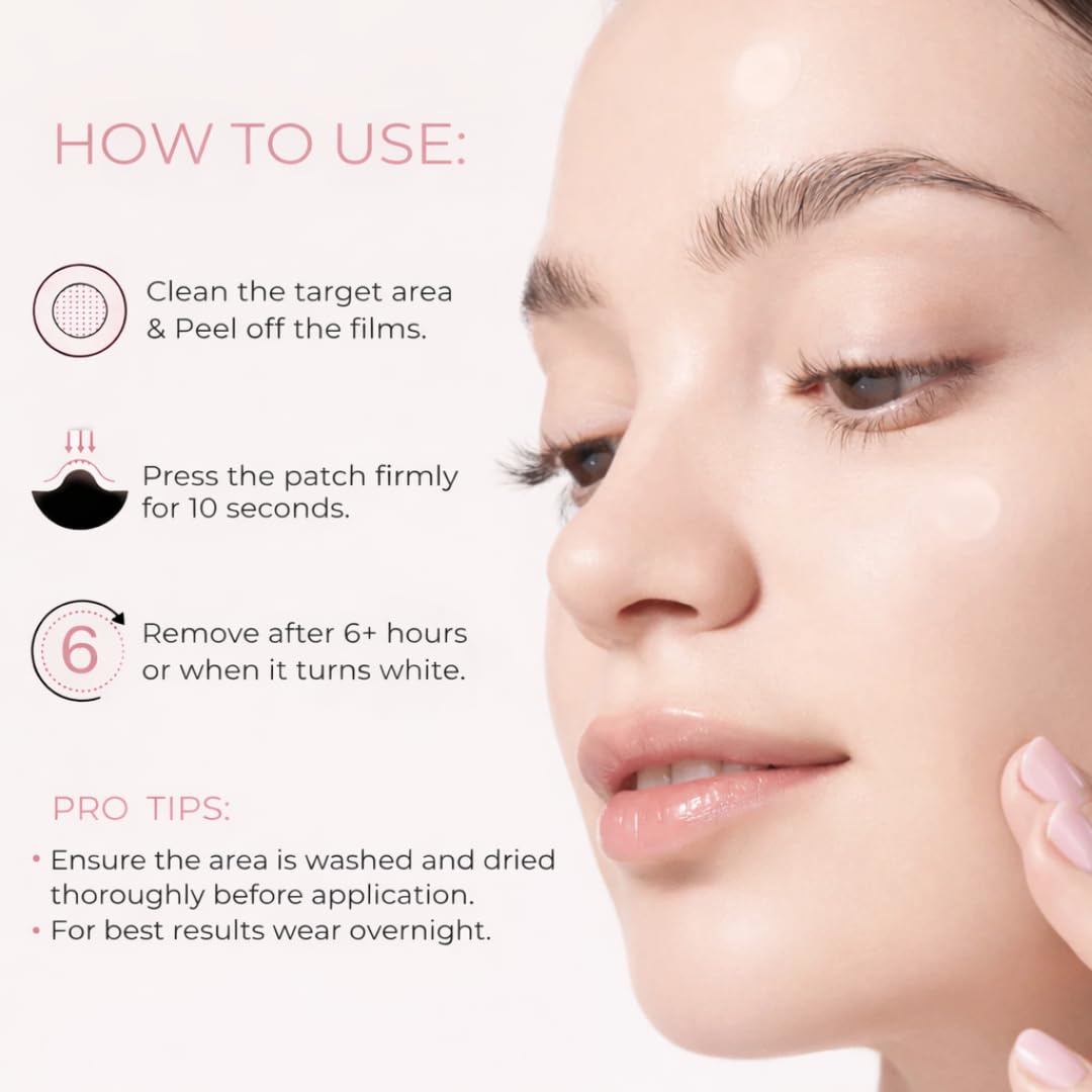Pimple Patches – Hydrocolloid Pimple Patch Spot Stickers for Acne and Whiteheads; Day or Nighttime Use; Fast Acting. Invisible Spot Treatment for Face and Skin- 72 Count : Beauty & Personal Care