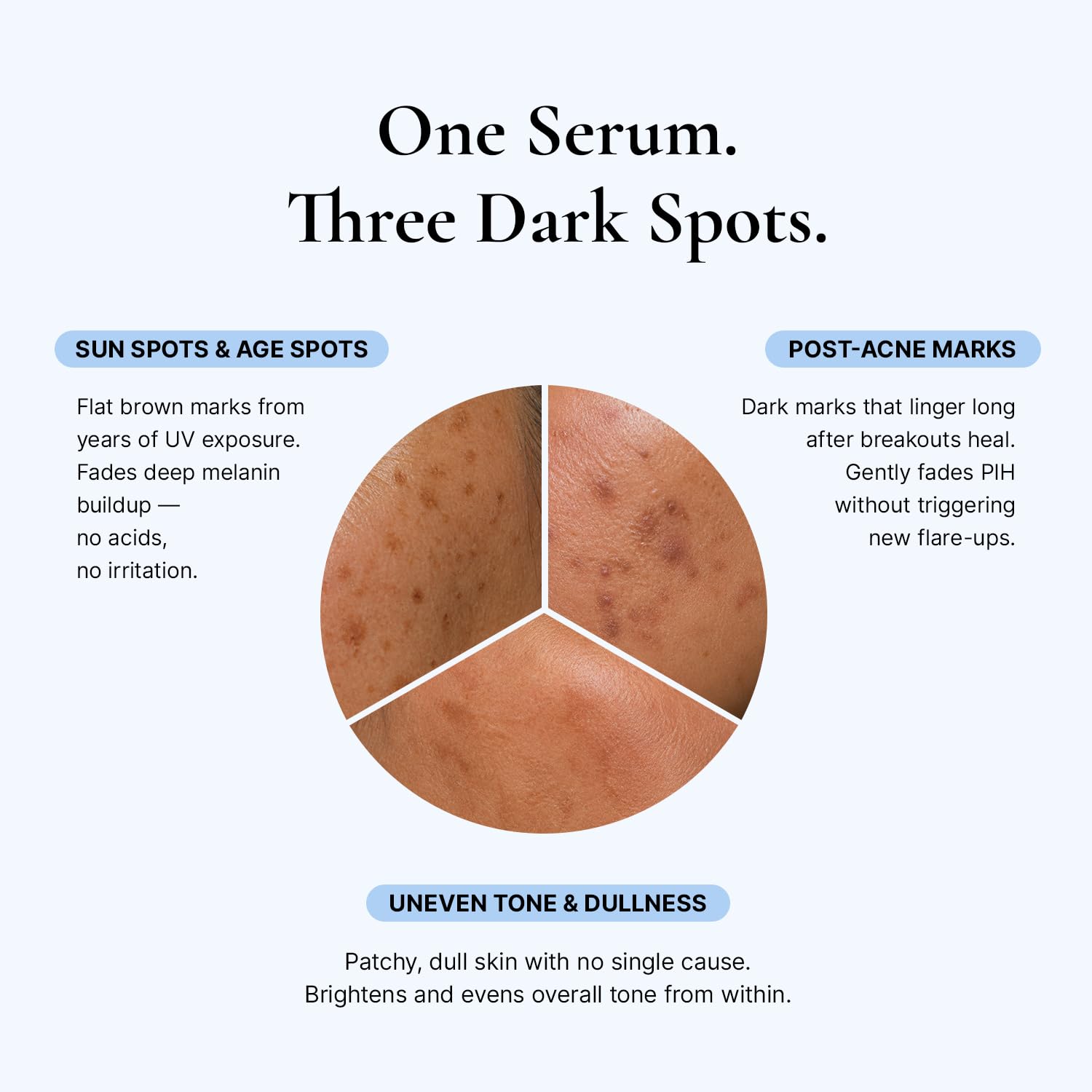 EnaSkin Dark Spot Corrector for Face & Body - 5% Tranexamic Acid. Niacinamide & Acid-Free Renewal Peptide - Hyperpigmentation. Melasma & Sun Spot Treatment. Gentle for Sensitive Skin. 1.01 fl oz : Beauty & Personal Care