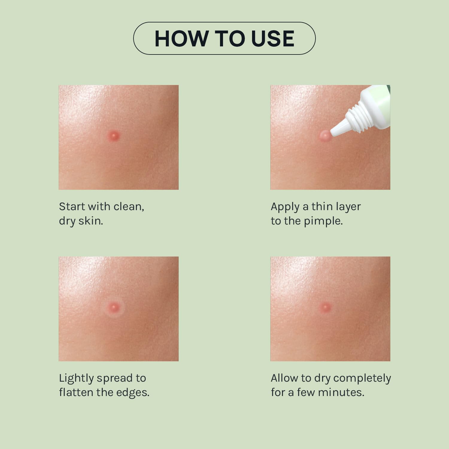 Skin Invisible Acne Liquid Patch - Invisible Spot Treatment with Witch Hazel & Salicylic Acid. Liquid Pimple Patch. Clear Fits to Makeup | 0.42 Fl Oz. 12g : Beauty & Personal Care
