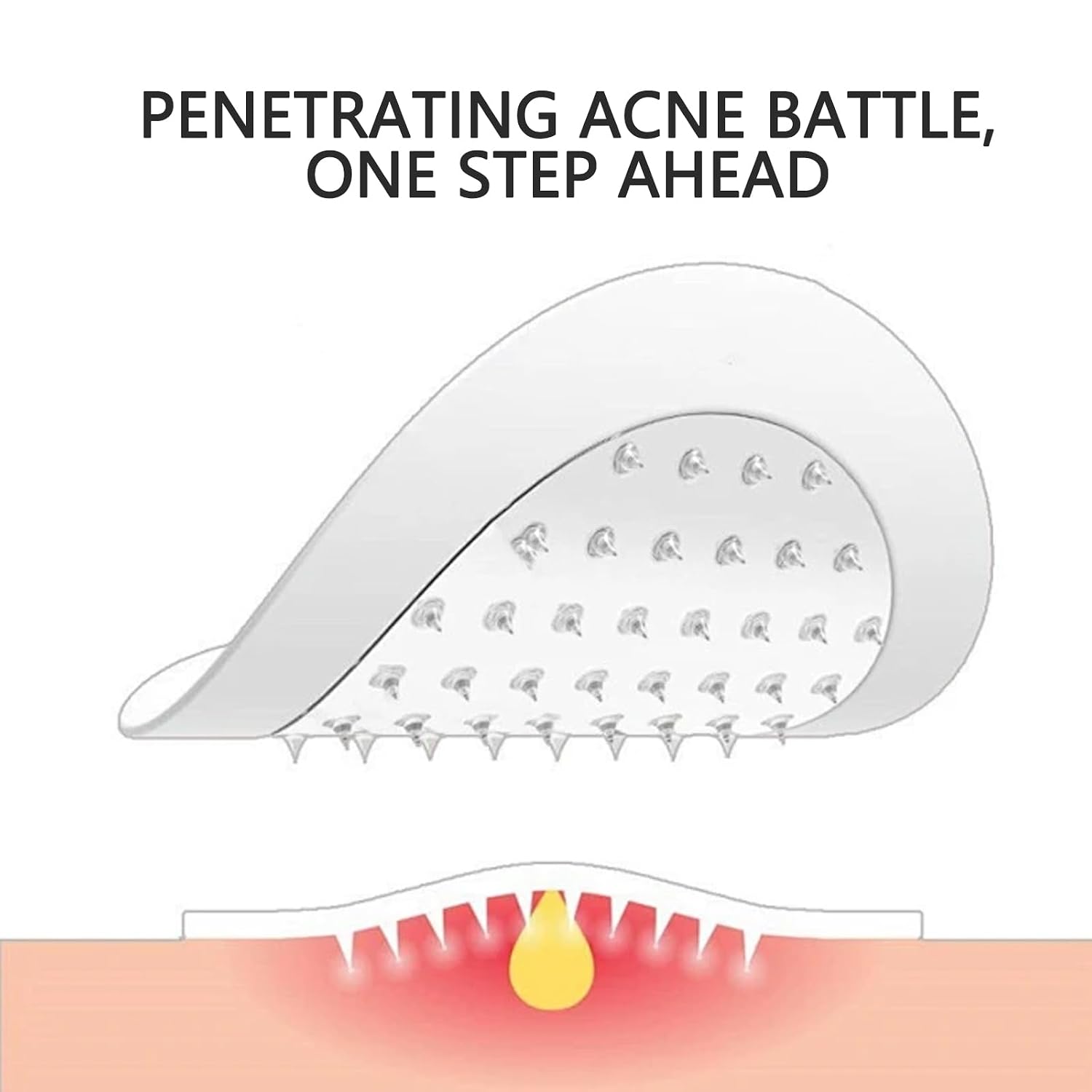 YIWMWIY Microdarts Pimple Patches for Face. Deep & Early-Stage Zit Care. 9 Count with Cleana Swab : Beauty & Personal Care