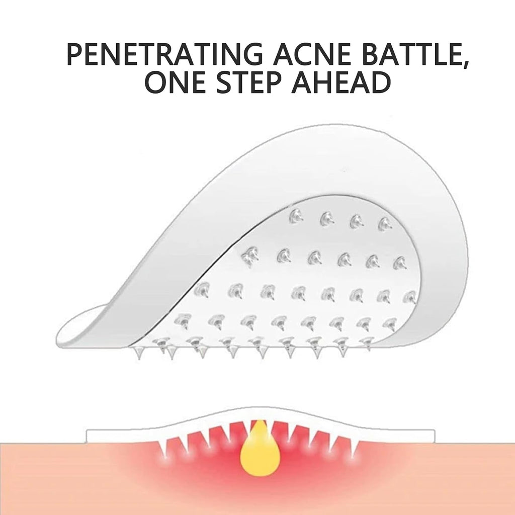 Microdarts Pimple Patches for Face. Deep & Early-Stage Zit Care. 9 Count with Cleana Swab