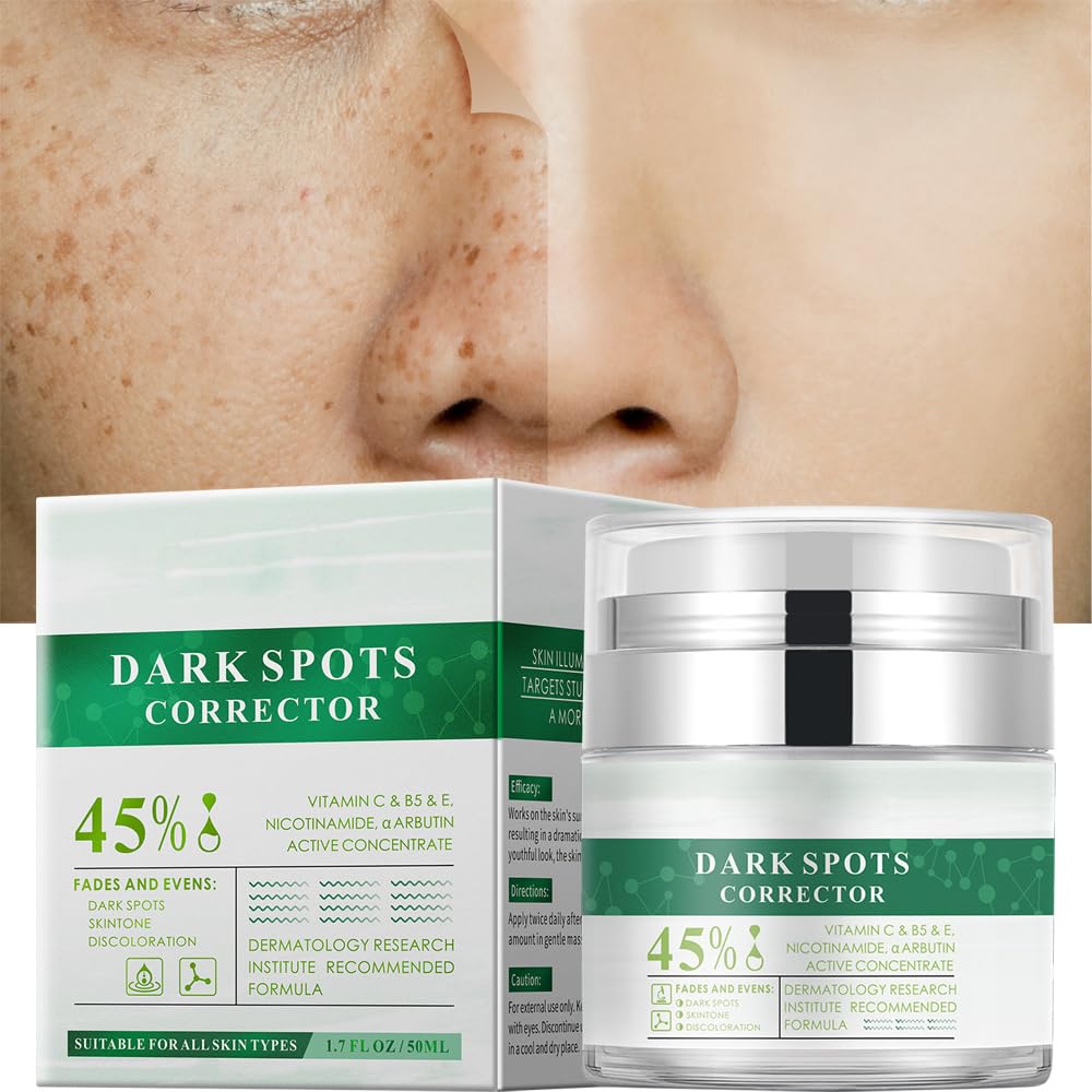Dark Spot Remover for Face and Body.Dark Spot Corrector with Vitamin C.Nicotinamide.Sun Spot Remover Cream for All Skin Types.Fade Age Spots.Melasma. Freckle. Blemish Reducer.1.7 Oz : Beauty & Personal Care