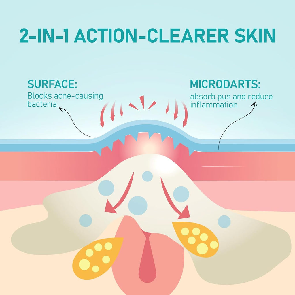ANGTICS Pimple Patches Microdart. Acne Patches with Microdart Technology. Salicylic Acid. Sodium Hyaluronate & Centella Extract. Zit Patches for Pimples. Blemishes