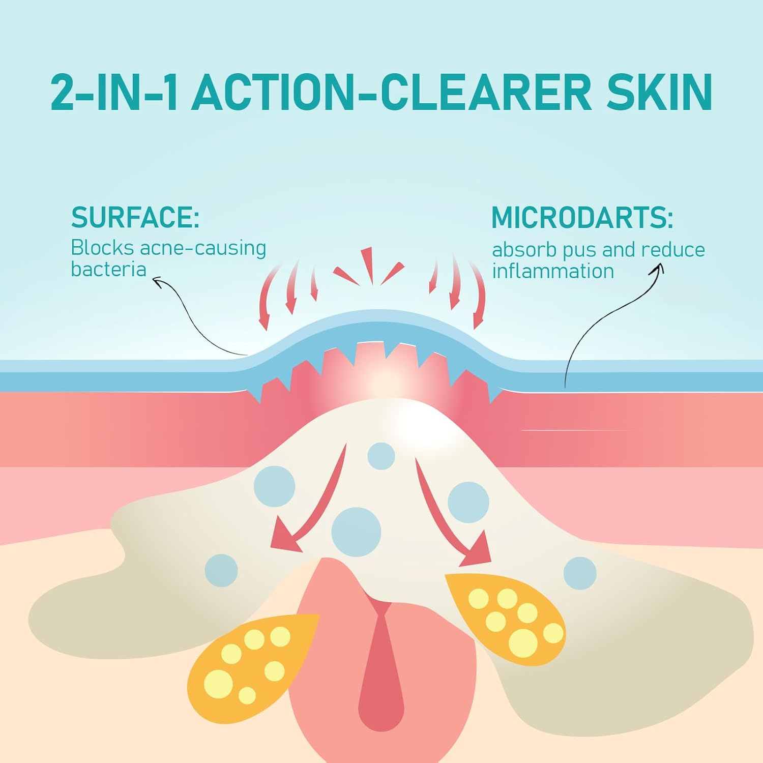 ANGTICS Pimple Patches Microdart. Acne Patches with Microdart Technology. Salicylic Acid. Sodium Hyaluronate & Centella Extract. Zit Patches for Pimples. Blemishes
