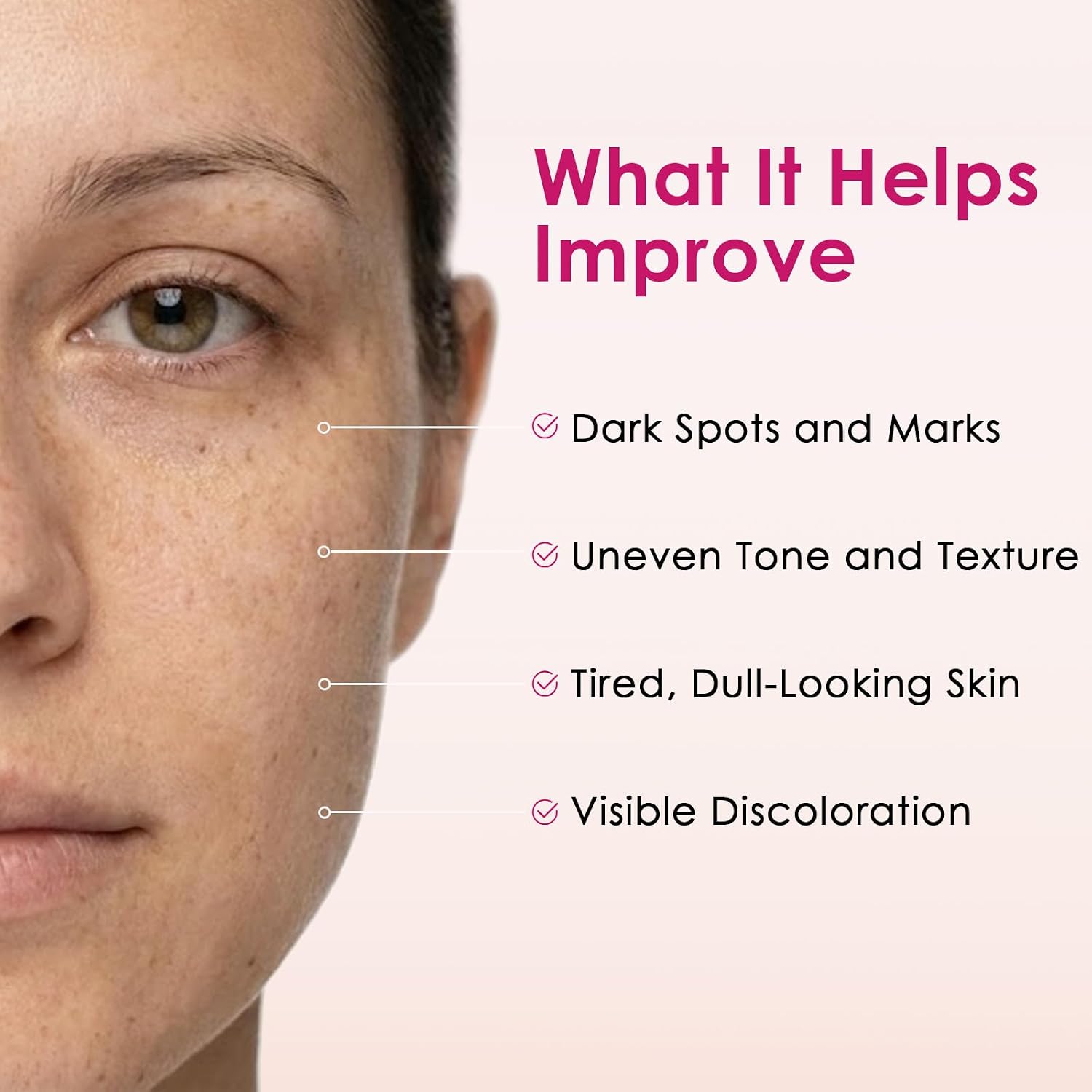 Arbutin 7% + Tranexamic Acid 4% Cream with Niacinamide 1% for Dark Spots & Pigmentation Concerns. Uneven Skin Tone – Moisturizing. Non-Irritating Skin Barrier Care for Sensitive Skin. 1.76 oz : Beauty & Personal Care