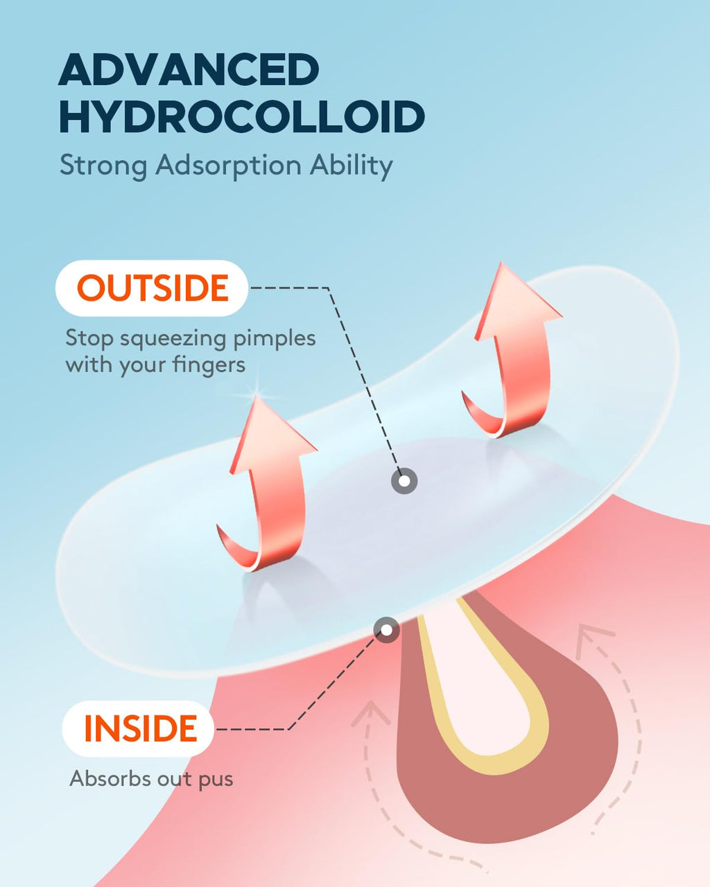 Pimple Patch (360 Counts 4 Sizes). Hydrocolliod Acne Patch for Face. Invisible Zit Patch with Tea Tree Oil & Calendula Oil. Blemish Patch
