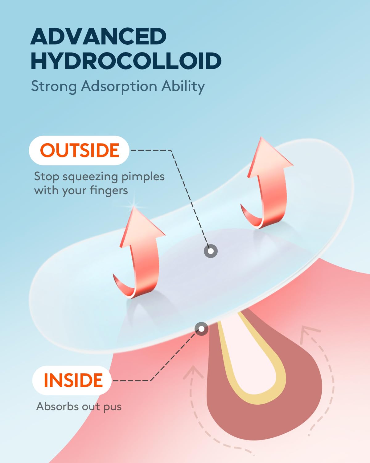 Pimple Patch (360 Counts 4 Sizes). Hydrocolliod Acne Patch for Face. Invisible Zit Patch with Tea Tree Oil & Calendula Oil. Blemish Patch