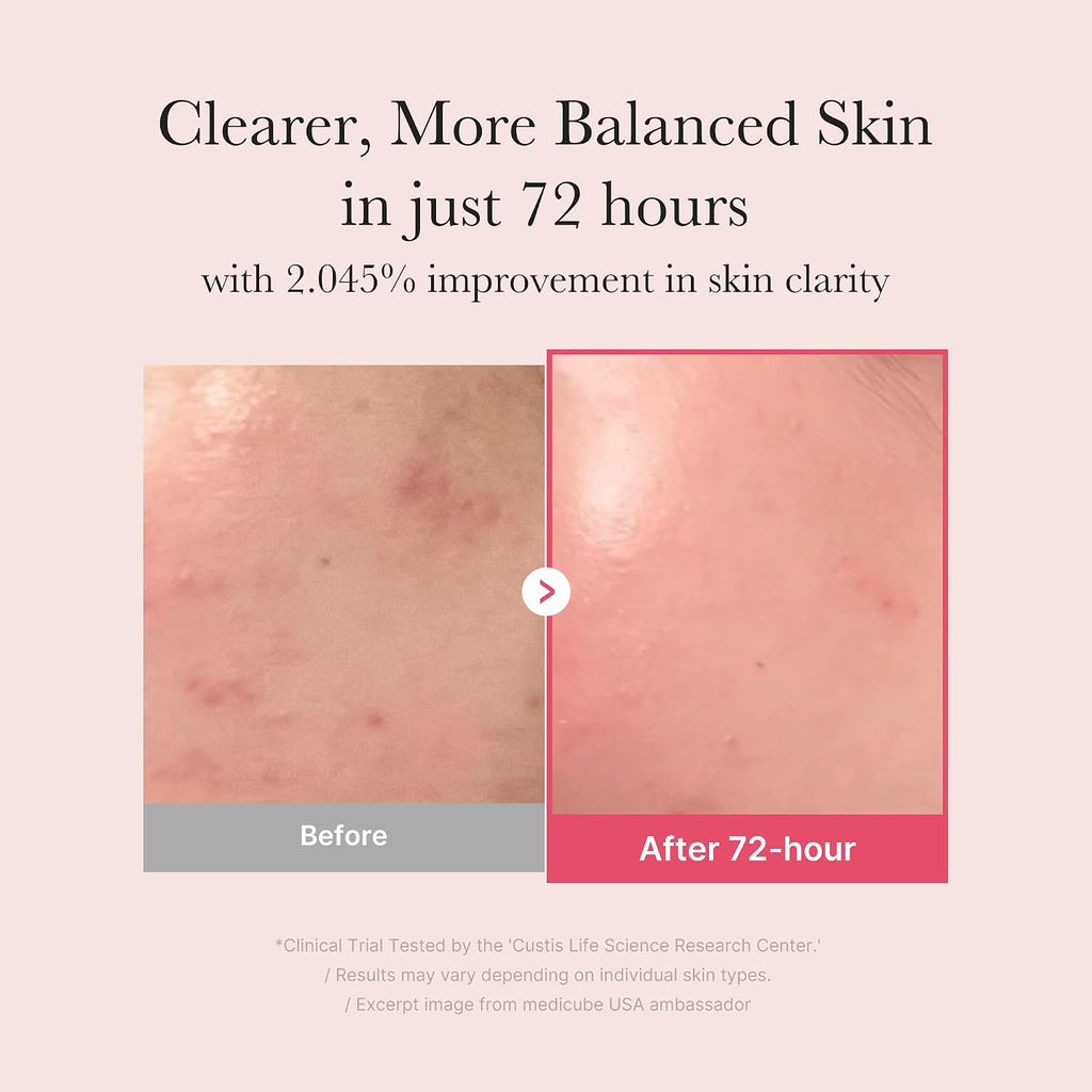 medicube TXA+Niacinamide 15% Glow Facial Serum for After Spot Care | All-in-One Daily Korean Skincare | Uneven Skin Tone. Texture. and Hydration Care | High-Potency Tranexamic Acid 5% | 1.01 fl.oz : Beauty & Personal Care