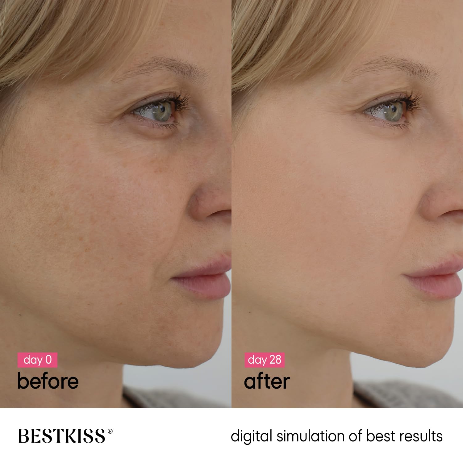 Bestkiss 10% Niacinamide 5% Tranexamic Acid 2% Alpha-Arbutin Dark Spot Serum with Ceramides. Hyaluronic Acid Centella & Asiatica - Vegan Paraben Fragrance Cruelty Free 1 FL OZ : Beauty & Personal Care