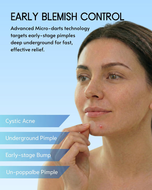 AICHUN BEAUTY Face Acne Cleaning Cream Skin Care Remove Repair Comedone Pimple Acne Face Acne Cream 30ml/1.0fl.oz