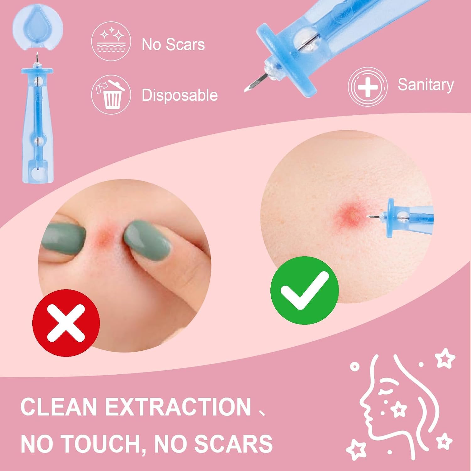Pimple Patches Set with Microdart Style & Hydrocolloid Patches – 3-Step Blemish Care Kit for Clearer-Looking Skin. Zit Patches for Face. Includes Hygiene Tools