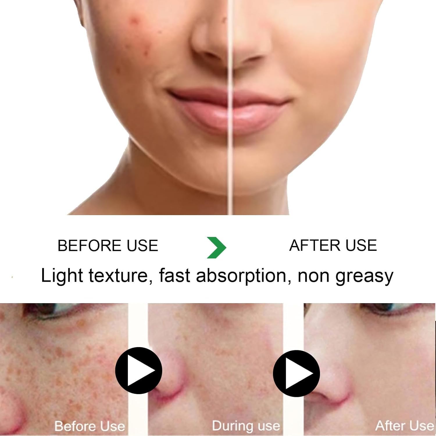 Melanina Anti-Melasma & Dark Kit. Anti-Melasma Serum+Collagen Jelly Cream. Ultra Moisturizer for Women. Supports Even Skin Tone & Radiance (SET) : Beauty & Personal Care
