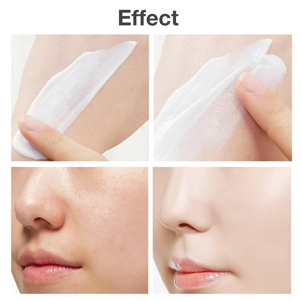 Cystic. Hormonal. Severe Acne Treatment Cream for Teens & Adults with Hyaluronic Acid Aloe Vera Oil Overnight Cystic . Unisex Sensitive Skin Blind Pimple & Blemish Remover