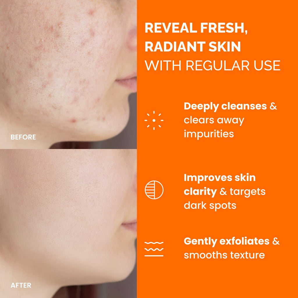 Kojic Acid and Turmeric Pads for Dark Spots – Lab Tested – 60 Face Cleansing Toner Pads with Ceramides. Niacinamide & Vitamin C : Beauty & Personal Care