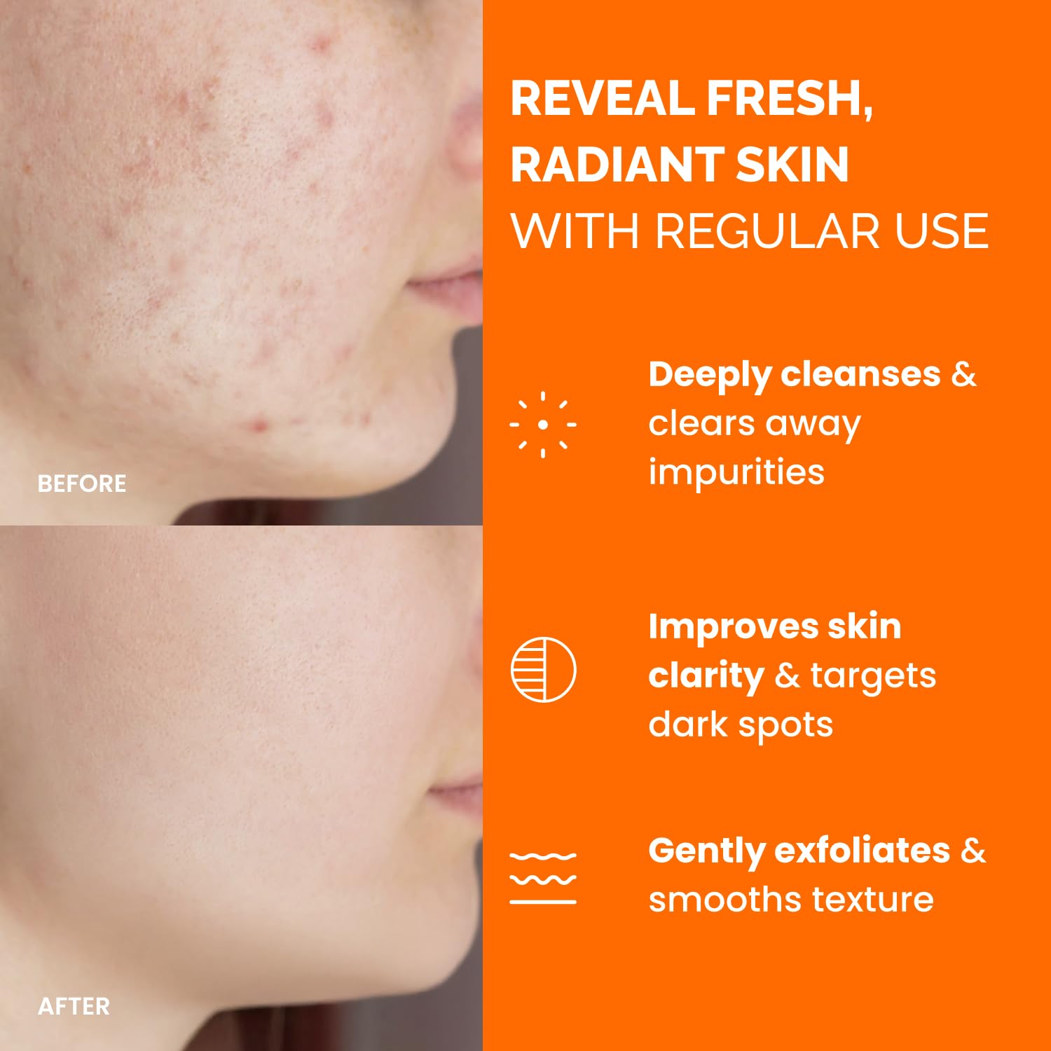 Kojic Acid and Turmeric Pads for Dark Spots – Lab Tested – 60 Face Cleansing Toner Pads with Ceramides. Niacinamide & Vitamin C : Beauty & Personal Care