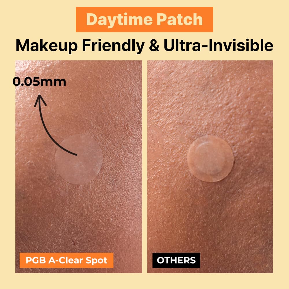 PGB A-CLEAR SPOT Pimple Patches. 3 Sizes – Day & Night Hydrocolloid Acne Patches – Invisible. Absorbs Zits & Blemishes. Korean Skin Care