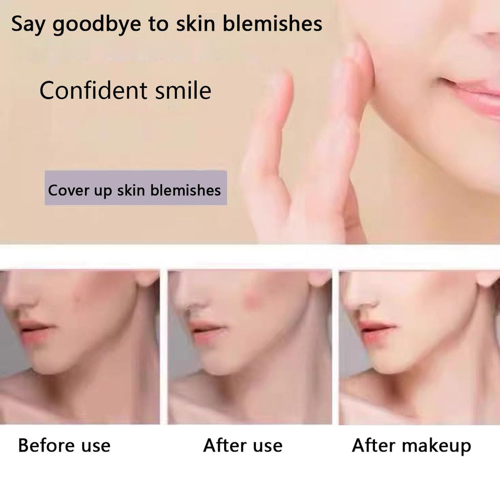 160pcs Knot Patches. Miracle Invisible Spot Coverage - Hydrocolloid Acne Patches with Tea essential oil salicylic acid and building block essence. treat acne. absorb pimples and blemishes in 2 sizes : Beauty & Personal Care