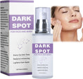 Dark Spot Remover for Face and Body: Dark Spot Corrector - Age Spot Sun Spot Freckles Dark Spot Remover. Melasma Treatment for Women and Men (1.7 FL OZ) : Beauty & Personal Care