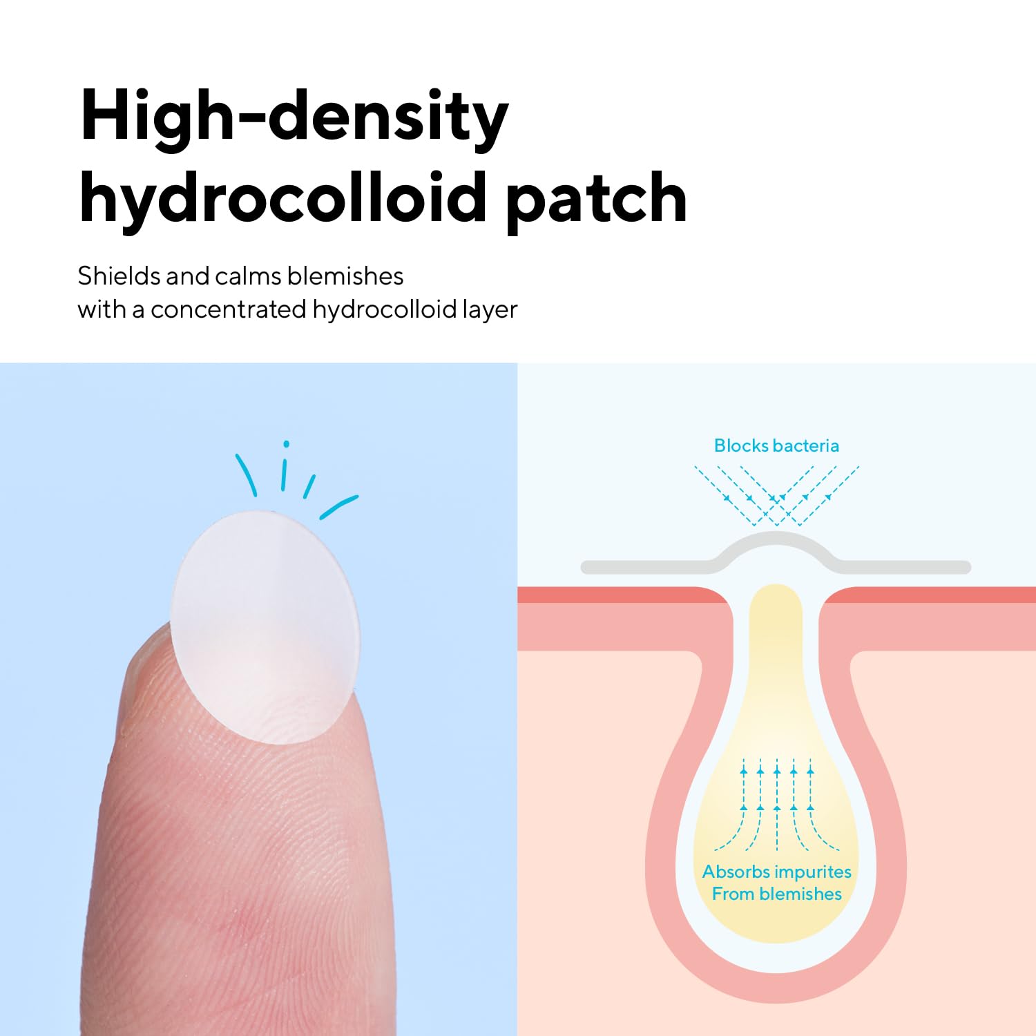 caraseoul Pimple Patches. 2 Size Hydrocolloid Acne Patch for Zits and Blemishes. Bakuchiol & Aloe Vera. Korean Skin Care. Easy to Use – Dermatology Tested