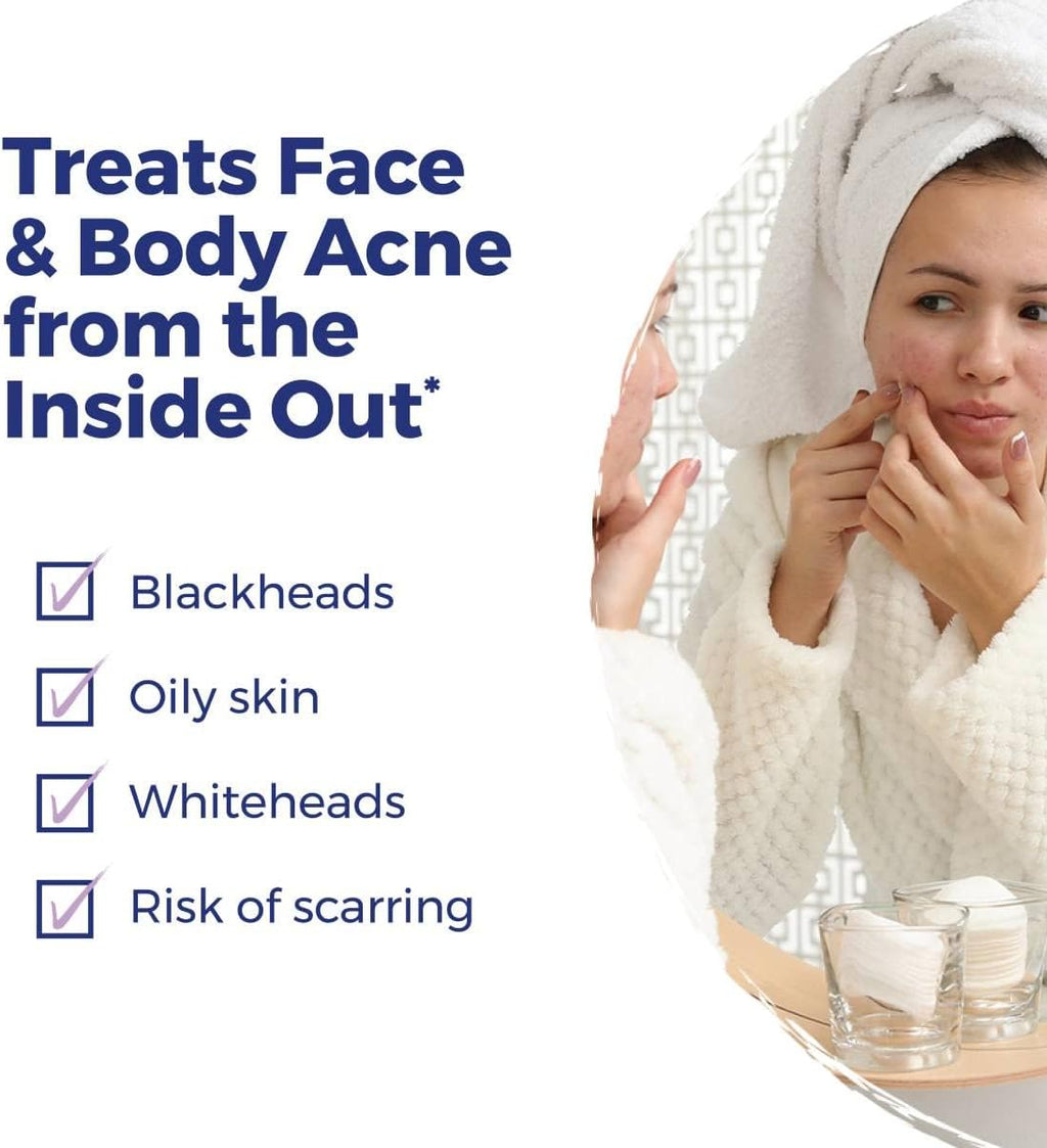 Acne Relief Kit for Blackheads. Oily Skins. Whiteheads on The Face and Body - 3 Count (240 Pellets) : Health & Household