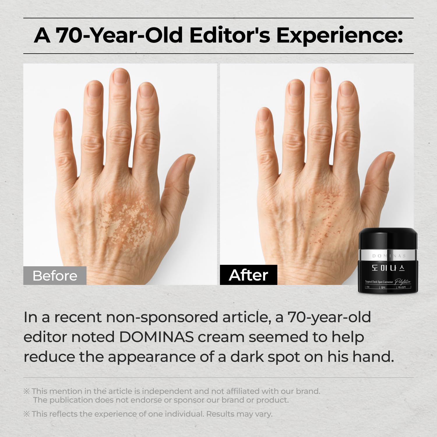 Acid Dark Spot Corrector Cream - Visibly Reduce Age Spots. Sun Spots with TXA. Niacinamide. Bakuchiol. Daily Moisturizer for Uneven Tone & After Spot Care. Korean Skincare. 1.76 oz : Beauty & Personal Care