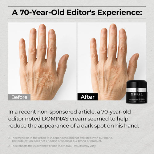 Acid Dark Spot Corrector Cream - Visibly Reduce Age Spots. Sun Spots with TXA. Niacinamide. Bakuchiol. Daily Moisturizer for Uneven Tone & After Spot Care. Korean Skincare. 1.76 oz : Beauty & Personal Care