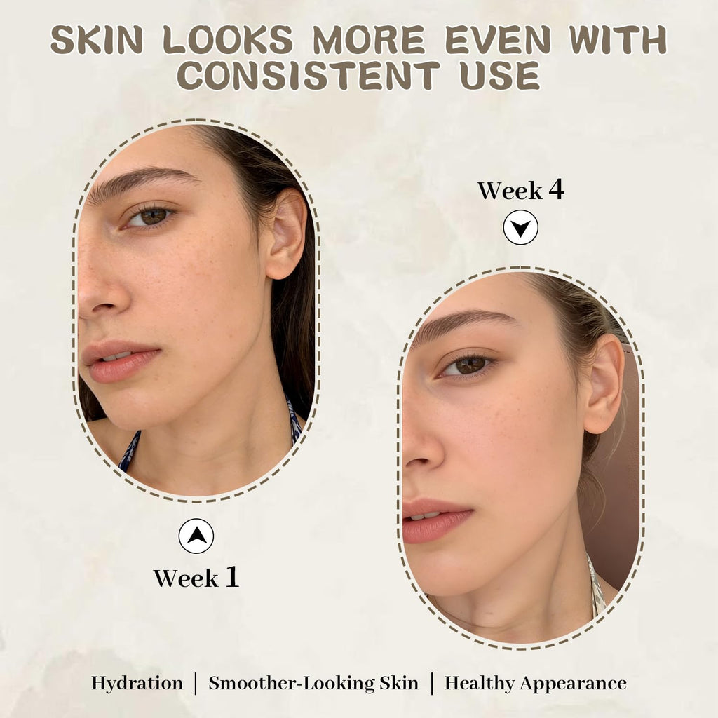 Dark Spot Remover & Corrector Serum with Niacinamide & Hyaluronic Acid - Face & Body Skincare Serum for Uneven Skin Tone. Melasma. Acne Scars & Sun Spots. Anti Aging Skincare for Women & Men. 1.06 oz : Beauty & Personal Care