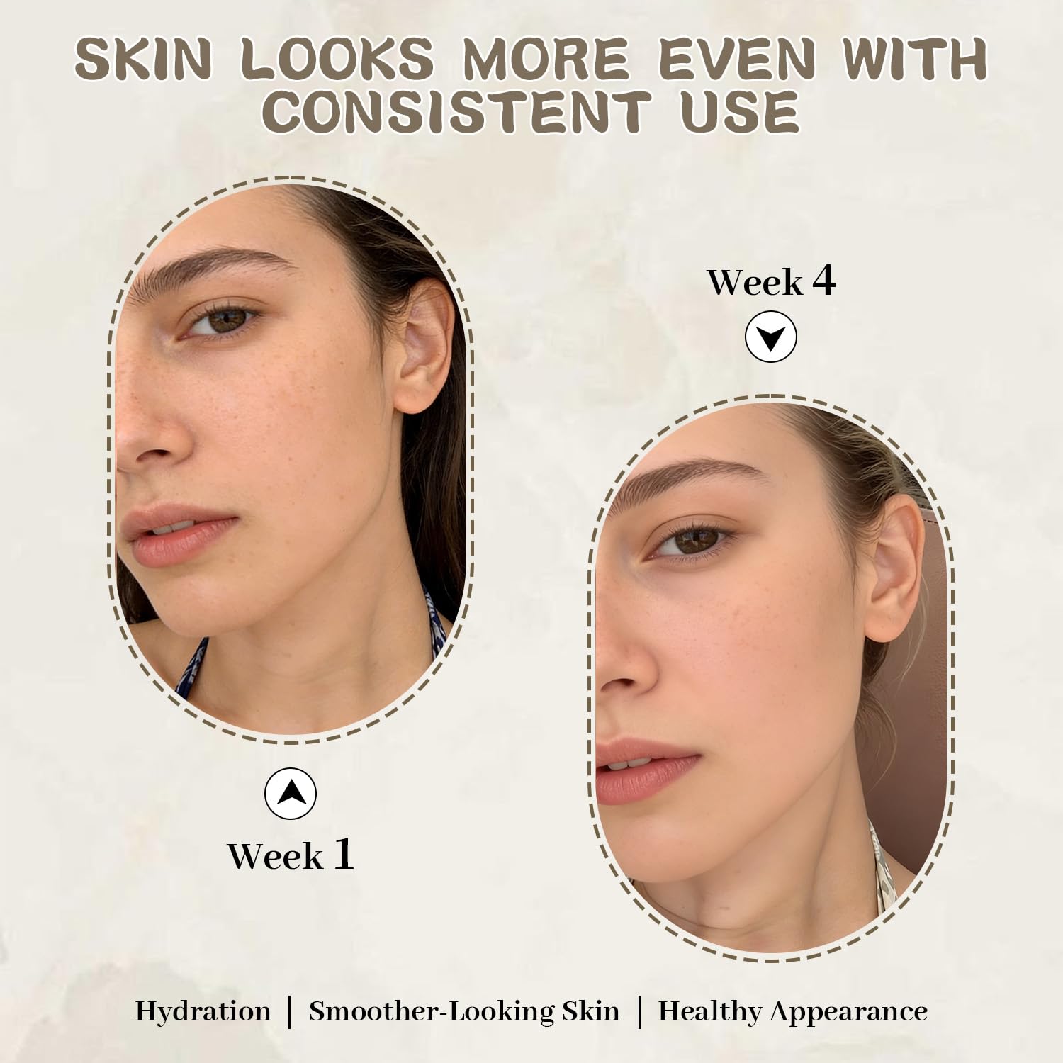 Dark Spot Remover & Corrector Serum with Niacinamide & Hyaluronic Acid - Face & Body Skincare Serum for Uneven Skin Tone. Melasma. Acne Scars & Sun Spots. Anti Aging Skincare for Women & Men. 1.06 oz : Beauty & Personal Care