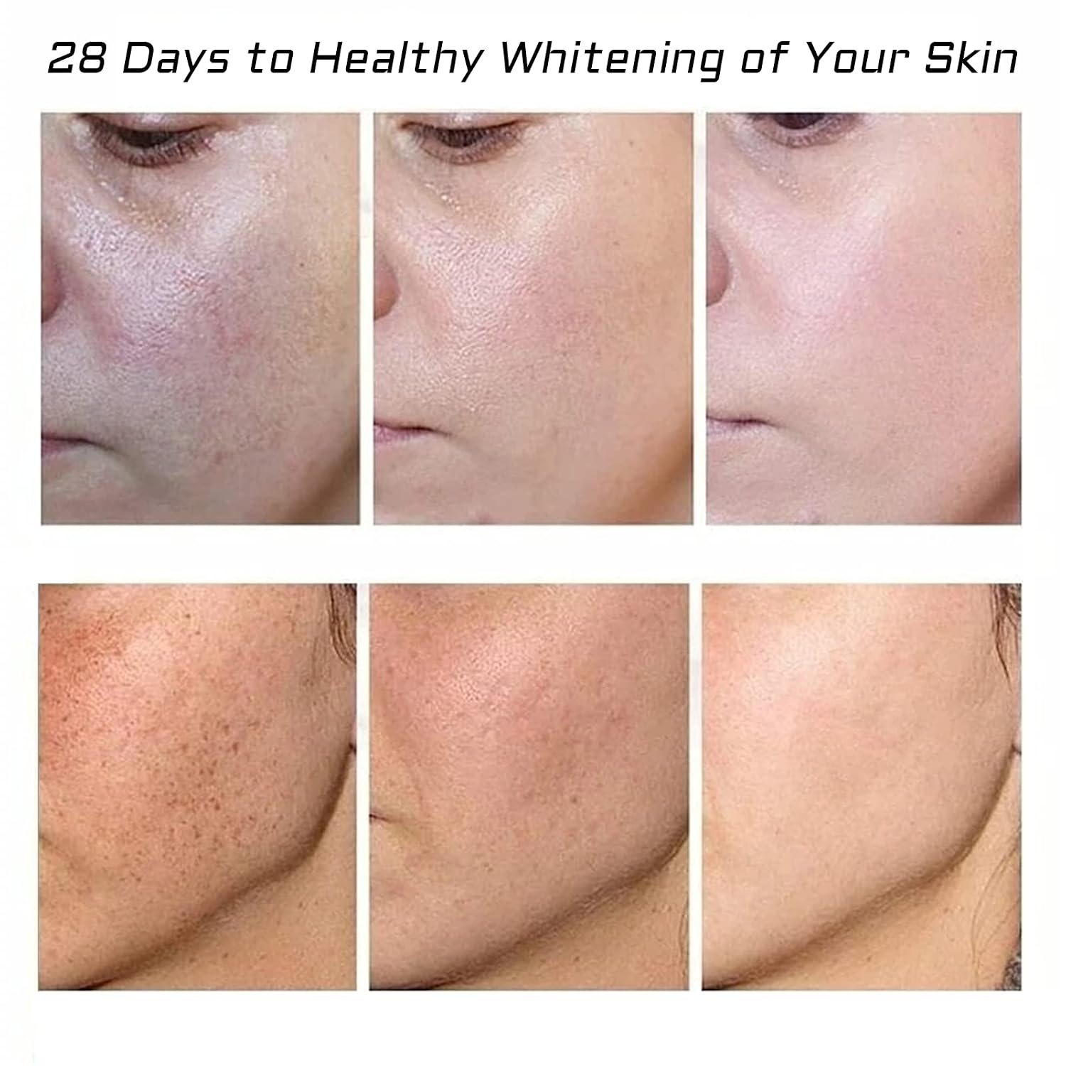 2 Pcs Whitening Freckle Cream. Acne Scar Removal Treatment Cream. Pigmentation Removal Cream for Face. Moisturizing Removes Facial Melasma Dark Spots Wrinkles Blemishes (whitening freckle cream) : Beauty & Personal Care