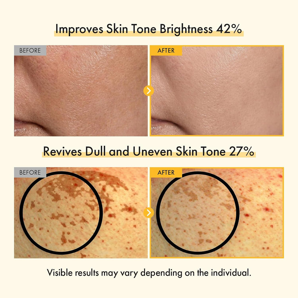Vitamin C Brightening Cream for Even Skin Tone. Hyperpigmentation and Dark Spot Care with Glutathione. Tocopherol (Vitamin E). Ferulic Acid and Peptides. Korean Skincare. 50 ml /1.69 fl. oz. : Beauty & Personal Care