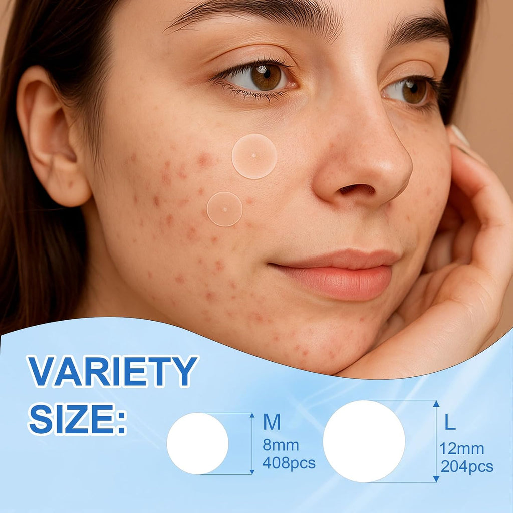 Amouy Acne Pimple Patch- 2 Sizes 612 Dots Thin & Thick Hydrocolloid Patches for Face with Witch Hazel. Tea Tree & Calendula Oil. Extra Adhesion Pimple Patches for Face Zit Patch Acne Dots : Beauty & Personal Care