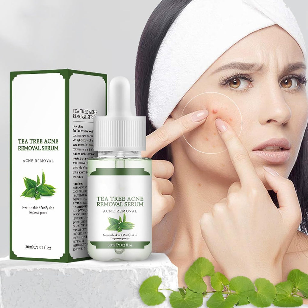Acne Removing Facial Serum.Natural Ingredients Professionally Remove Acne Marks.For Teens & Adults Anti-acne Moisturizer Acne Removal Serum : Beauty & Personal Care