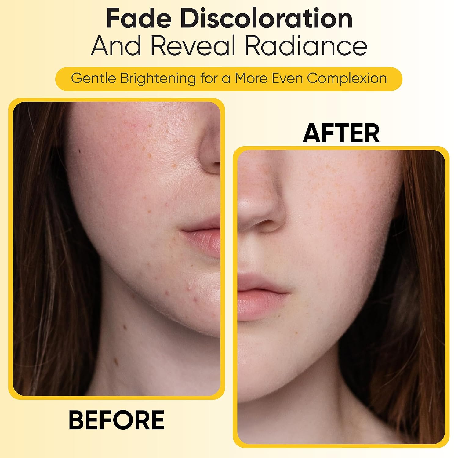 Kojic Acid & Turmeric Facial Cleansing Pads. 50 Count. Vitamin C. Gentle Exfoliating Cotton Pads for Brighter & Refreshed Looking Skin. Daily Facial Cleansing Pads : Beauty & Personal Care