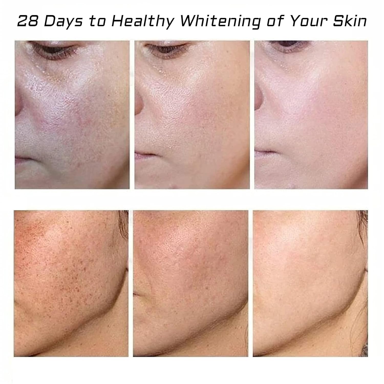 Crema para Manchas Oscuras en La Cara. Cremas para Quitar Manchas de La Cara. Crema Blanqueadora para Pecas. Elimina el Melasma Manchas Oscuras Aclara La Piel. 20g/0.71oz