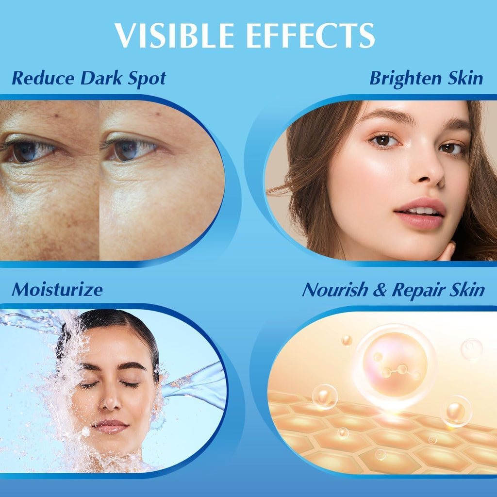 Dark Spot Remover for Face: Hyperpigmentation Body Treatment for Freckles Melasma Age Spot Sun Spot - Dark Spots Corrector Serum for Women and Men