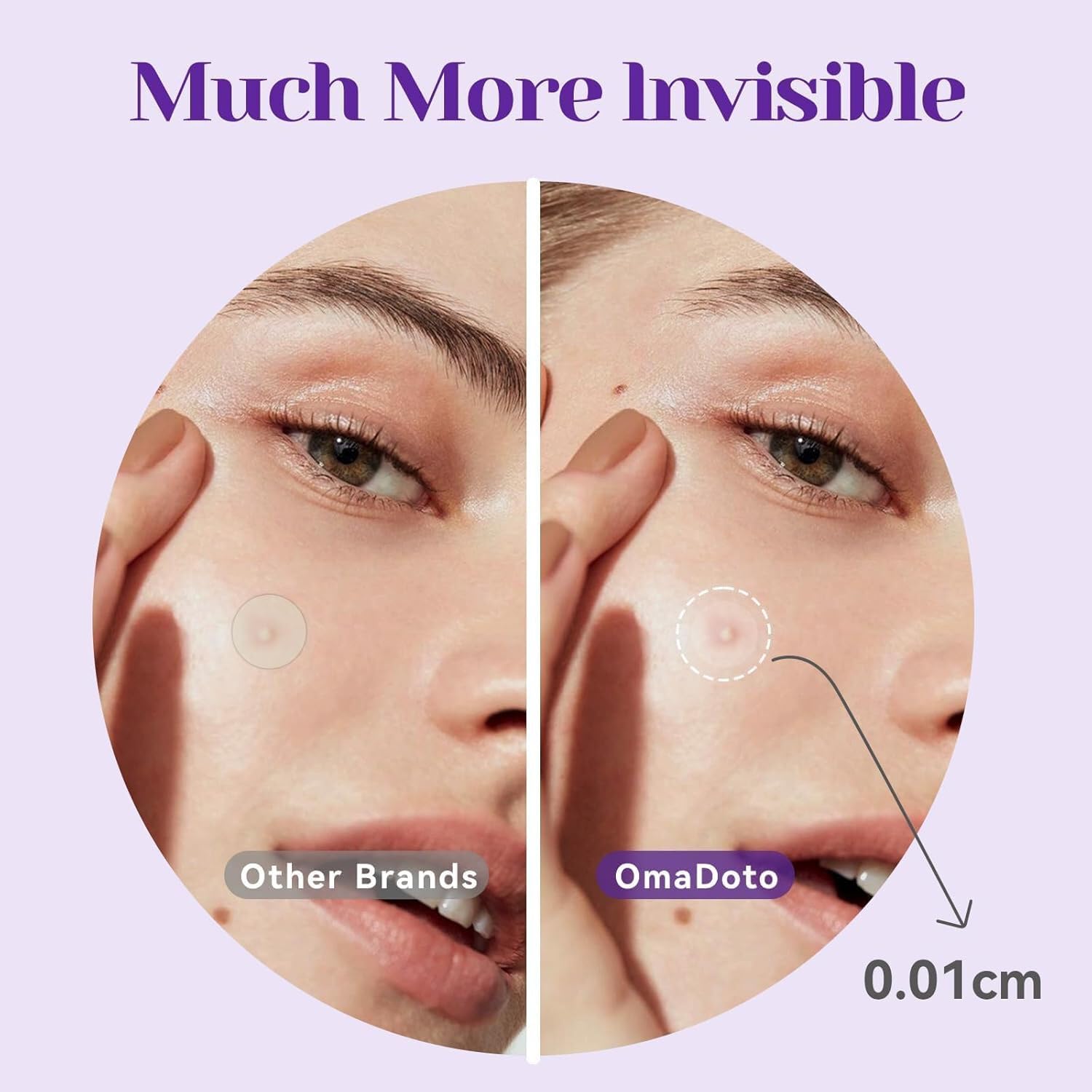 OmaDoto Salicylic Acid Acne Patches - Overnight Spot Treatment with BHA. Absorbs & Helps Unclog. 2 Sizes (10mm & 12mm). 72 Count. Easy-Peel Sheets