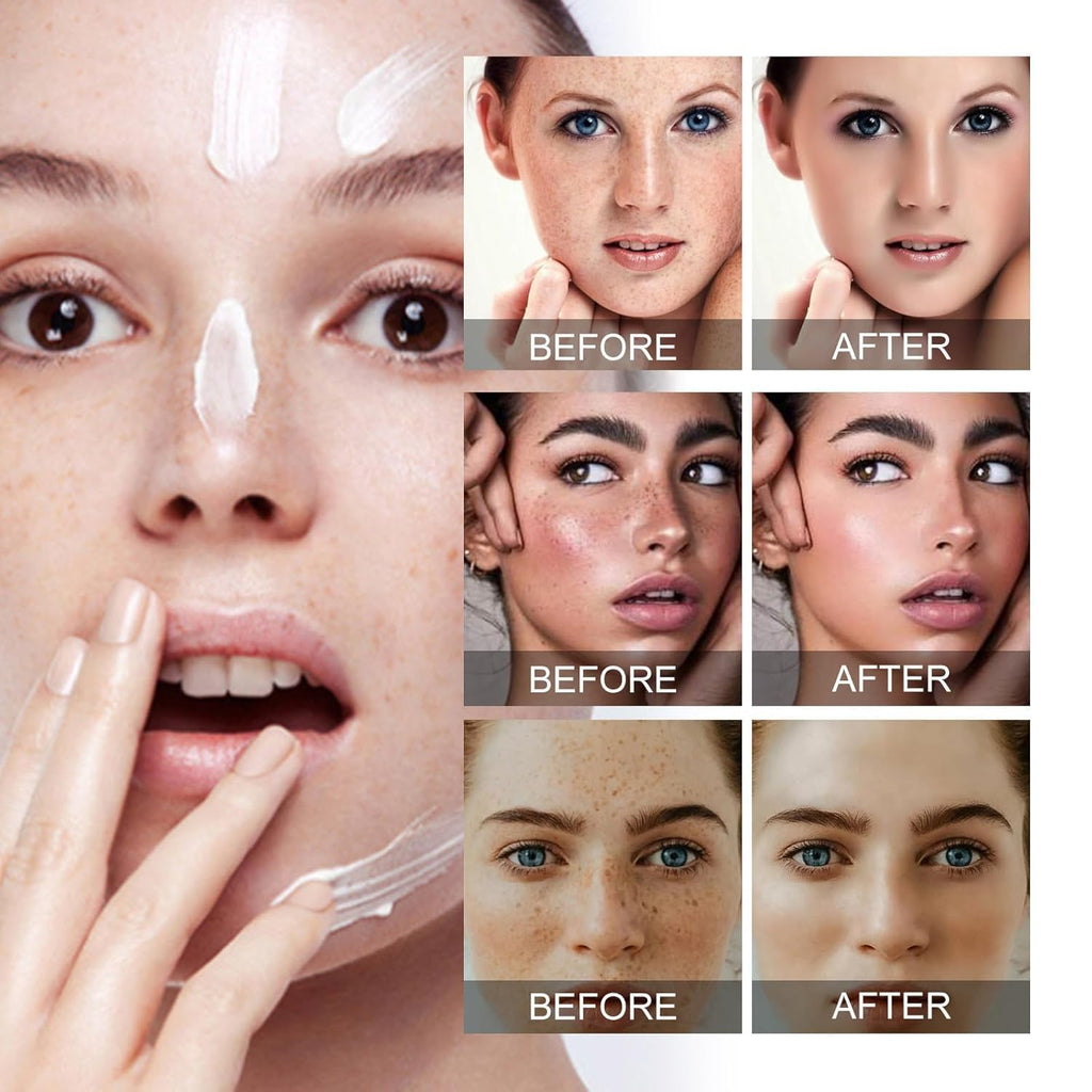 Crema para Manchas Oscuras en La Cara. Cremas para Quitar Manchas de La Cara. Crema Blanqueadora para Pecas. Elimina el Melasma Manchas Oscuras Aclara La Piel. 20g/0.71oz