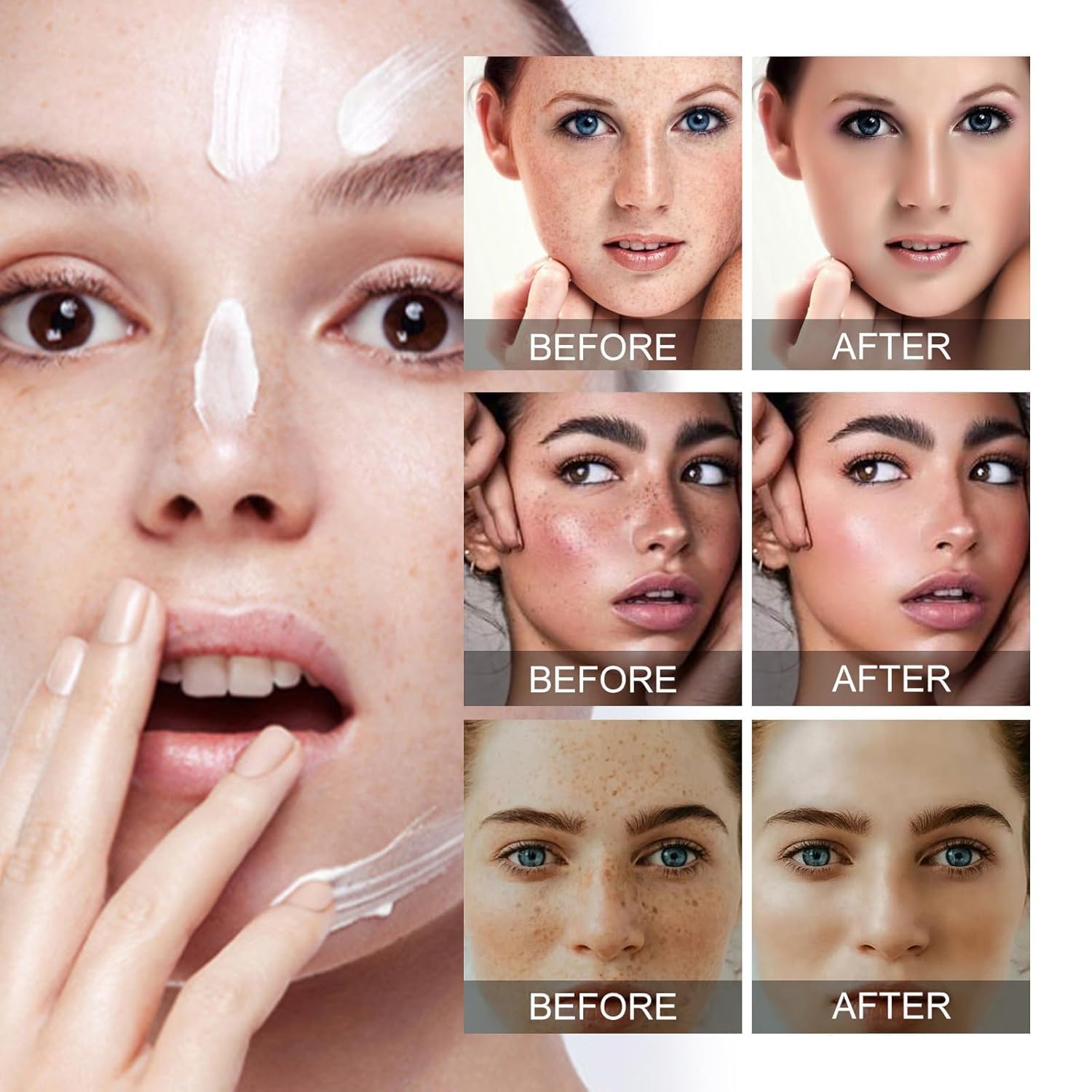 Crema para Manchas Oscuras en La Cara. Cremas para Quitar Manchas de La Cara. Crema Blanqueadora para Pecas. Elimina el Melasma Manchas Oscuras Aclara La Piel. 20g/0.71oz