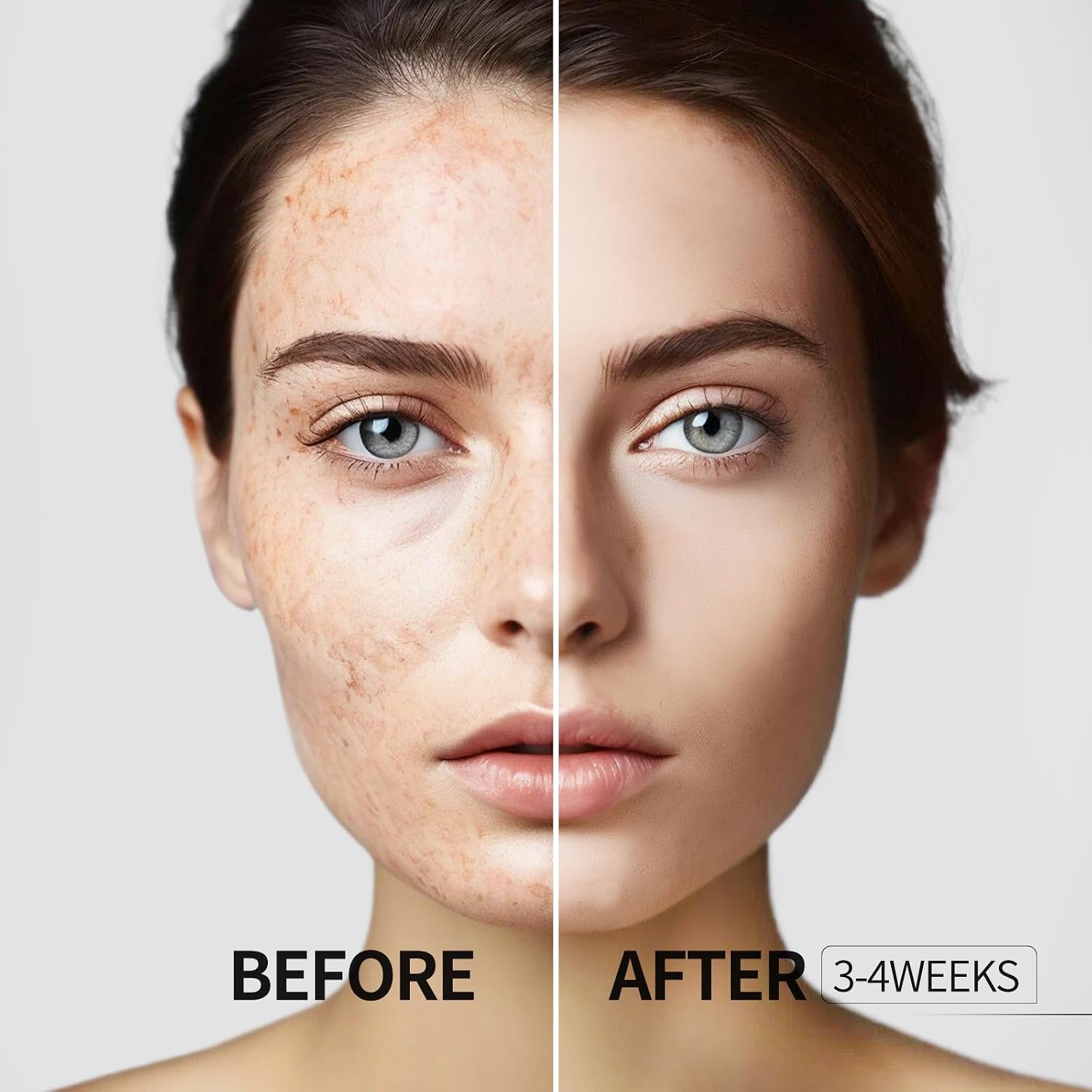 Dark Spot Remover for Face and Body. Dark Spot Corrector Serum. Age Spot Sun Spot Freckles Brown Spot Remover. Melasma Treatment for Face. Skin Care Serum with Roller : Beauty & Personal Care