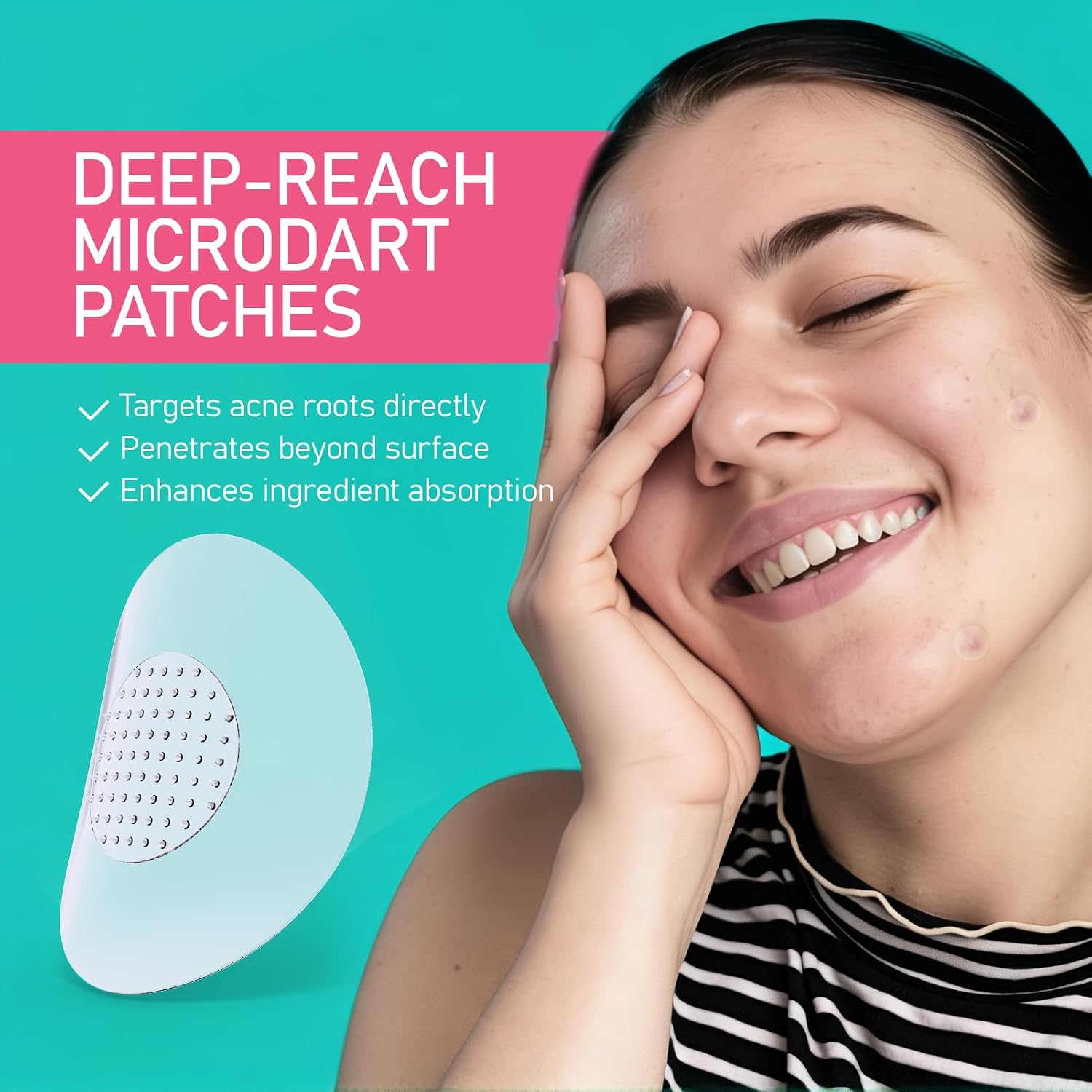ANGTICS Pimple Patches Microdart. Acne Patches with Microdart Technology. Salicylic Acid. Sodium Hyaluronate & Centella Extract. Zit Patches for Pimples. Blemishes