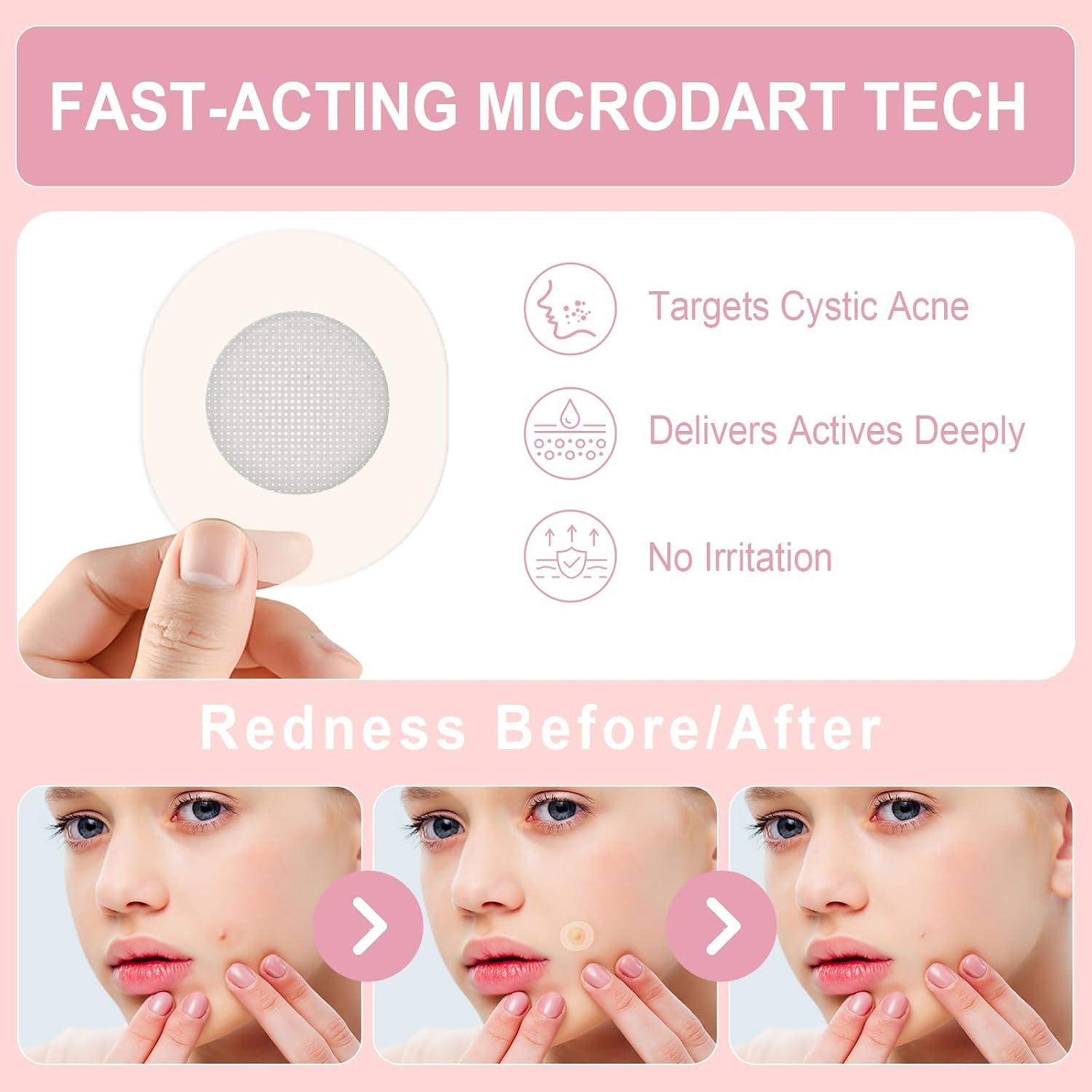 Pimple Patches Set with Microdart Style & Hydrocolloid Patches – 3-Step Blemish Care Kit for Clearer-Looking Skin. Zit Patches for Face. Includes Hygiene Tools