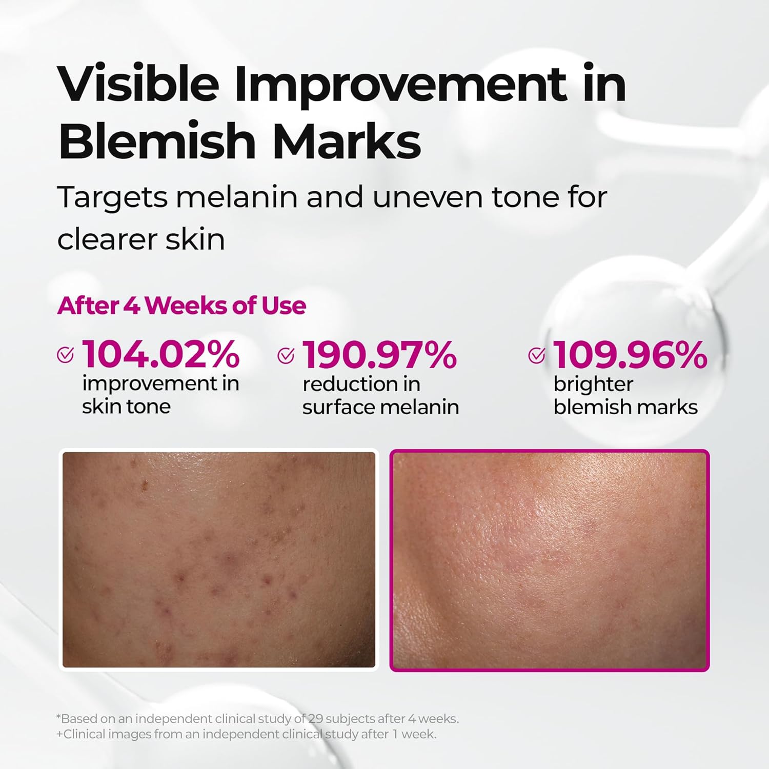 Dr.Melaxin Picotonic Shot Serum 1.01 fl.oz - Alpha-Arbutin and Niacinamide Dark Spot Corrector Serum. Pigmentation Corrector for Uneven Skin Tone. Blemish Marks. K-Beauty Face Serum : Beauty & Personal Care