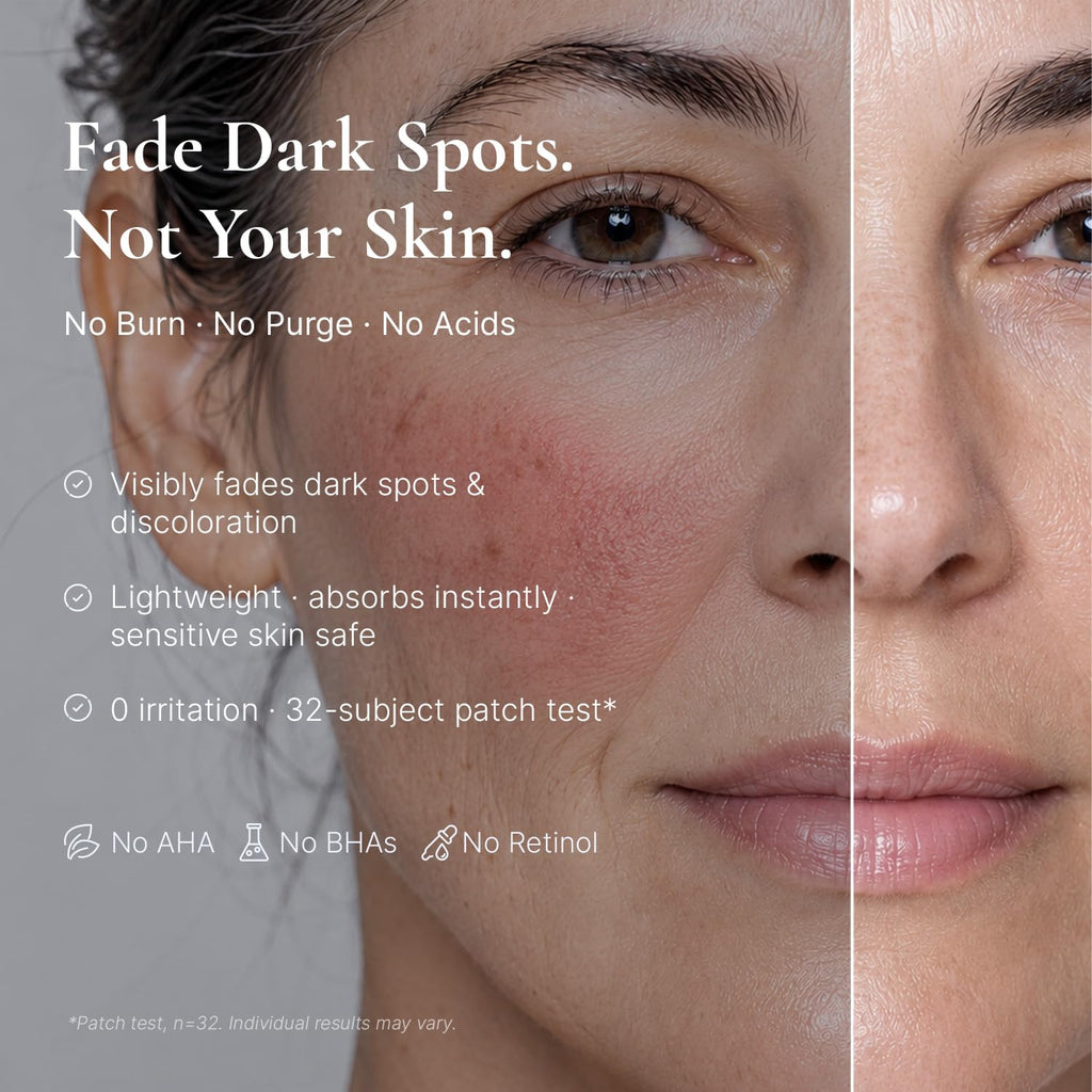 EnaSkin Dark Spot Corrector for Face & Body - 5% Tranexamic Acid. Niacinamide & Acid-Free Renewal Peptide - Hyperpigmentation. Melasma & Sun Spot Treatment. Gentle for Sensitive Skin. 1.01 fl oz : Beauty & Personal Care