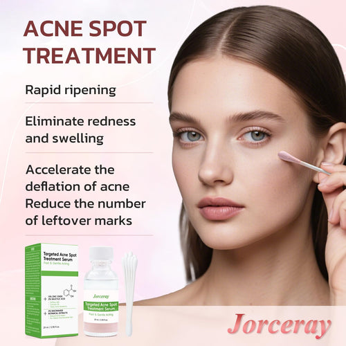 Acne Treatment for Face - Acne Drying lotion - Removes Acne and Redness - Eliminating Zits - Pimple Drying Lotion 1 Fl oz